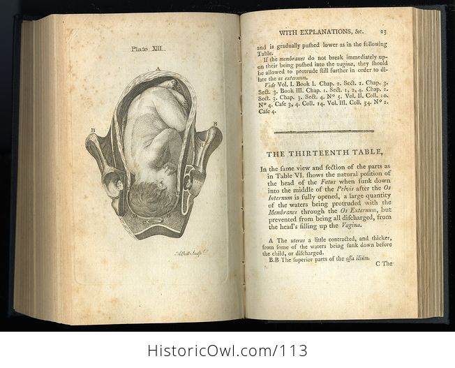 Antique Illustrated Book Outlines of the Theory and Practice of Midwifery by Alexander Hamilton C1784 - #FTpX2a3ttR0-11