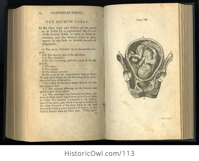 Antique Illustrated Book Outlines of the Theory and Practice of Midwifery by Alexander Hamilton C1784 - #FTpX2a3ttR0-10