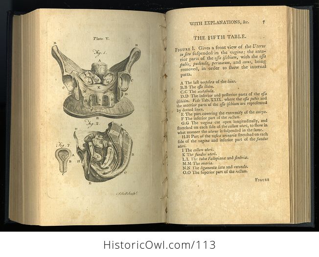 Antique Illustrated Book Outlines of the Theory and Practice of Midwifery by Alexander Hamilton C1784 - #FTpX2a3ttR0-9