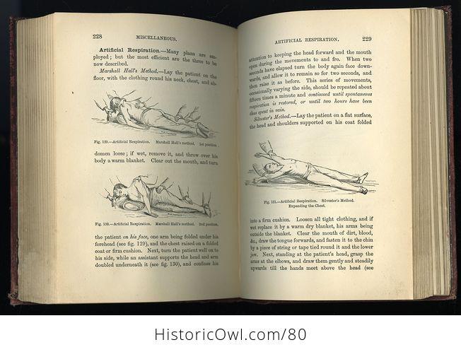 Antique Illustrated Book the Essentials of Bandaging by Berkeley Hill C 1883 - #sqUeCCtipRg-13