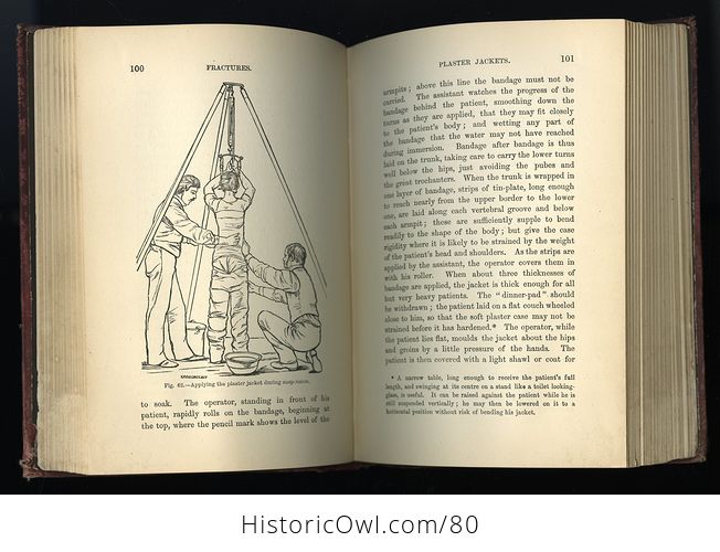Antique Illustrated Book the Essentials of Bandaging by Berkeley Hill C 1883 - #sqUeCCtipRg-10