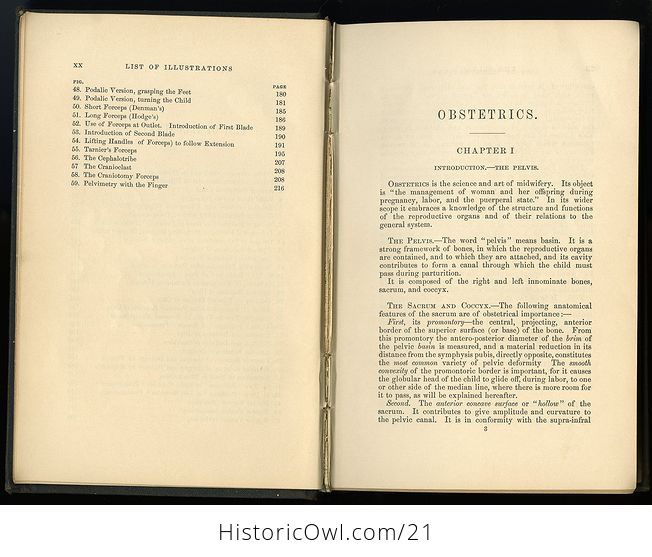 Kings Manual of Obstetrics Antique Illustration Book C 1884 - #FOL6lxEkGJs-6