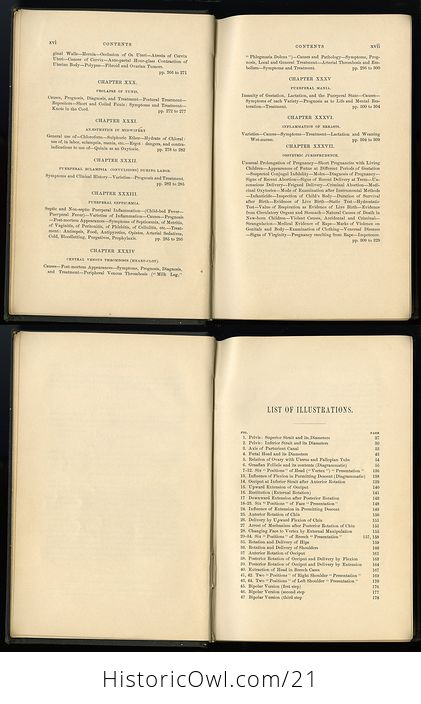 Kings Manual of Obstetrics Antique Illustration Book C 1884 - #FOL6lxEkGJs-7